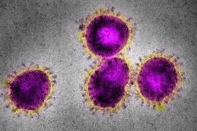 Coronavirus 1 (image d'illustration DR).