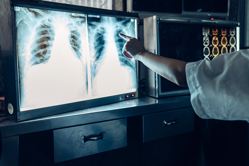 Les agents CMR sont suspectés d’être une source importante des cancers professionnels. Crédit : kelvnkelvn/AdobeStock Les agents CMR sont suspectés d’être une source importante des cancers professionnels. Crédit : kelvnkelvn/AdobeStock